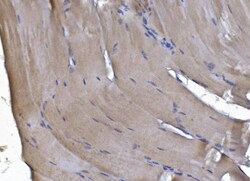 Invitrogen PAK2 Polyclonal Antibody 100 &mu;g; Unconjugated:Antibodies,
