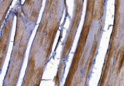 Invitrogen PAK2 Polyclonal Antibody 100 &mu;g; Unconjugated:Antibodies,