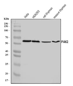Invitrogen PAK2 Polyclonal Antibody 100 &mu;g; Unconjugated:Antibodies,