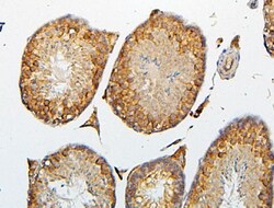 Invitrogen CRB1 Polyclonal Antibody 100 &mu;g; Unconjugated:Antibodies,
