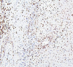 Invitrogen CRB1 Polyclonal Antibody 100 &mu;g; Unconjugated:Antibodies,