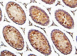 Invitrogen CRB1 Polyclonal Antibody 100 &mu;g; Unconjugated:Antibodies,