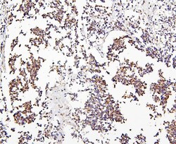 Invitrogen CRB1 Polyclonal Antibody 100 &mu;g; Unconjugated:Antibodies,