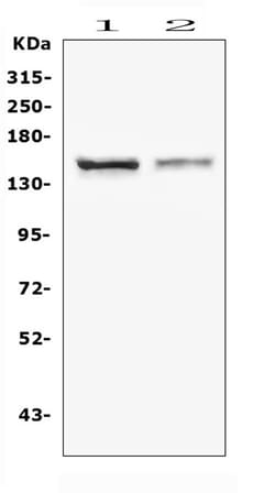 Invitrogen CRB1 Polyclonal Antibody 100 &mu;g; Unconjugated:Antibodies,