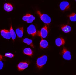 Invitrogen BUBR1 Polyclonal Antibody 100 μg; Unconjugated:Antibodies,