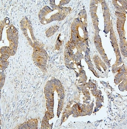 Invitrogen BUBR1 Polyclonal Antibody 100 μg; Unconjugated:Antibodies,