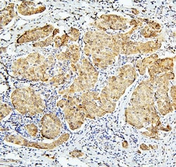 Invitrogen BUBR1 Polyclonal Antibody 100 μg; Unconjugated:Antibodies,