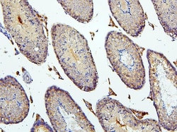 Invitrogen BUBR1 Polyclonal Antibody 100 μg; Unconjugated:Antibodies,