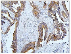 Invitrogen BUBR1 Polyclonal Antibody 100 μg; Unconjugated:Antibodies,