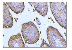 Invitrogen BUBR1 Polyclonal Antibody 100 μg; Unconjugated:Antibodies,
