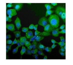 Invitrogen NPC2 Polyclonal Antibody 100 &mu;g; Unconjugated:Antibodies,