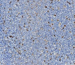 Invitrogen NPC2 Polyclonal Antibody 100 &mu;g; Unconjugated:Antibodies,
