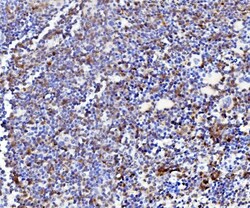 Invitrogen NPC2 Polyclonal Antibody 100 &mu;g; Unconjugated:Antibodies,