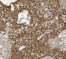 Invitrogen MTTP Polyclonal Antibody 100 &mu;g; Unconjugated:Antibodies,
