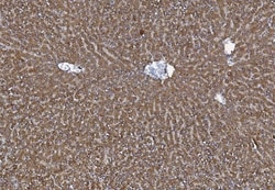Invitrogen MTTP Polyclonal Antibody 100 &mu;g; Unconjugated:Antibodies,