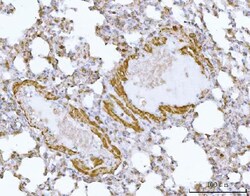 Invitrogen HBEGF Polyclonal Antibody 100 &mu;g | Buy Online | Invitrogen&trade; | Fisher Scientific