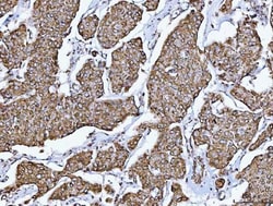 Invitrogen GluD1/GluD2 Polyclonal Antibody 100 &mu;g | Buy Online | Invitrogen&trade; | Fisher Scientific