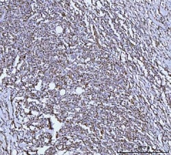 Invitrogen GluD1/GluD2 Polyclonal Antibody 100 &mu;g | Buy Online | Invitrogen&trade; | Fisher Scientific