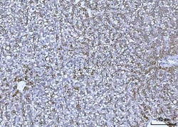 Invitrogen GluD1/GluD2 Polyclonal Antibody 100 &mu;g | Buy Online | Invitrogen&trade; | Fisher Scientific
