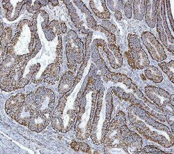 Invitrogen GluD1/GluD2 Polyclonal Antibody 100 &mu;g | Buy Online | Invitrogen&trade; | Fisher Scientific