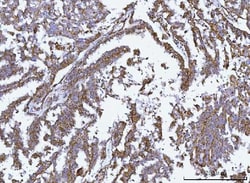 Invitrogen GluD1/GluD2 Polyclonal Antibody 100 &mu;g | Buy Online | Invitrogen&trade; | Fisher Scientific