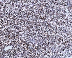 Invitrogen GluD1/GluD2 Polyclonal Antibody 100 &mu;g | Buy Online | Invitrogen&trade; | Fisher Scientific