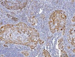Invitrogen GluD1/GluD2 Polyclonal Antibody 100 &mu;g | Buy Online | Invitrogen&trade; | Fisher Scientific
