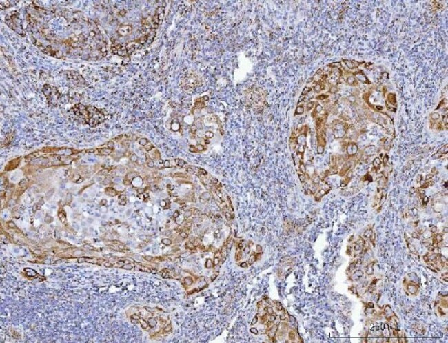 GluD1/GluD2 Polyclonal Antibody, Invitrogen 100 μg; Unconjugated