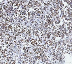 Invitrogen GluD1/GluD2 Polyclonal Antibody 100 &mu;g | Buy Online | Invitrogen&trade; | Fisher Scientific
