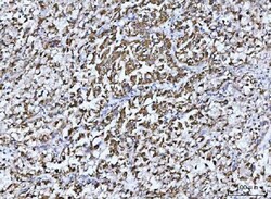 Invitrogen GluD1/GluD2 Polyclonal Antibody 100 &mu;g | Buy Online | Invitrogen&trade; | Fisher Scientific