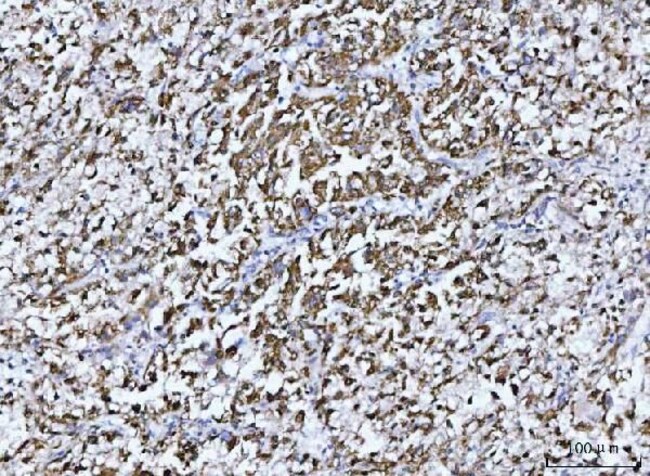 GluD1/GluD2 Polyclonal Antibody, Invitrogen 100 μg; Unconjugated