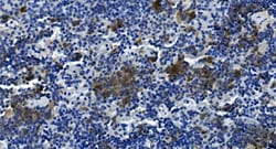 Invitrogen TIGIT Polyclonal Antibody 100 &mu;g | Buy Online | Invitrogen&trade; | Fisher Scientific