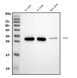 Invitrogen TIGIT Polyclonal Antibody 100 &mu;g | Buy Online | Invitrogen&trade; | Fisher Scientific