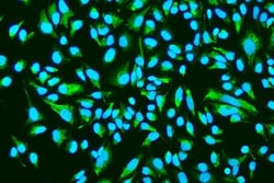 Invitrogen ASAH1 Polyclonal Antibody 100 &mu;g; Unconjugated:Antibodies,