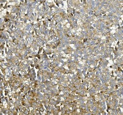 Invitrogen ASAH1 Polyclonal Antibody 100 &mu;g; Unconjugated:Antibodies,