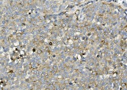 Invitrogen ASAH1 Polyclonal Antibody 100 &mu;g; Unconjugated:Antibodies,