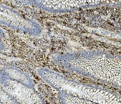 Invitrogen ASAH1 Polyclonal Antibody 100 &mu;g; Unconjugated:Antibodies,