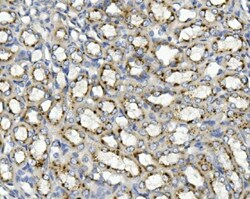 Invitrogen ASAH1 Polyclonal Antibody 100 &mu;g; Unconjugated:Antibodies,