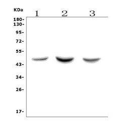 Invitrogen ASAH1 Polyclonal Antibody 100 &mu;g; Unconjugated:Antibodies,