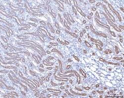 Invitrogen Prostate Specific Acid Phosphatase Polyclonal Antibody 100 &mu;g;