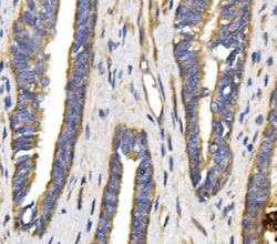Invitrogen GLUT9 Polyclonal Antibody 100 &mu;g; Unconjugated:Antibodies,