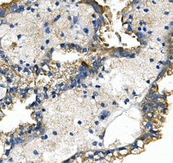 Invitrogen GLUT9 Polyclonal Antibody 100 &mu;g; Unconjugated:Antibodies,