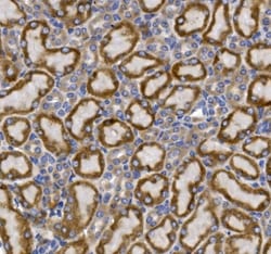 Invitrogen GLUT9 Polyclonal Antibody 100 &mu;g; Unconjugated:Antibodies,