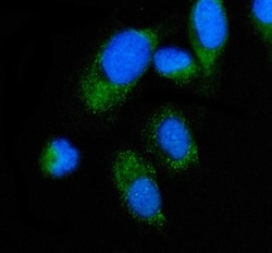 Invitrogen ALAS2 Polyclonal Antibody 100 &mu;g; Unconjugated:Antibodies,