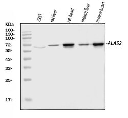 Invitrogen ALAS2 Polyclonal Antibody 100 &mu;g; Unconjugated:Antibodies,