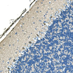 Invitrogen Ankyrin 1 Polyclonal Antibody 100 &mu;g | Buy Online | Invitrogen&trade; | Fisher Scientific