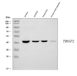 Invitrogen TM6SF2 Polyclonal Antibody 100 &mu;g; Unconjugated:Anticuerpos