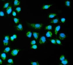 Invitrogen CLPB Polyclonal Antibody 100 &mu;g | Buy Online | Invitrogen&trade; | Fisher Scientific