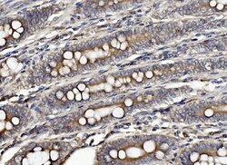 Invitrogen CLPB Polyclonal Antibody 100 &mu;g | Buy Online | Invitrogen&trade; | Fisher Scientific