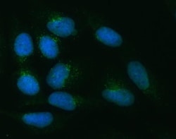 Invitrogen ZNRF3 Polyclonal Antibody 100 &mu;g; Unconjugated:Antibodies,